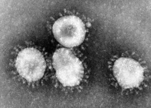 Coronavirusul SARS-CoV agentul patogen al sindromului respirator sever acut.