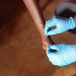 OMS avertizează asupra creșterii cazurilor de mpox: recomandări pentru controlul răspândirii
