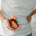 Când să mergi la medic pentru o ecografie renală?