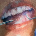 Smalțul dentar se poate regenera? Specialiștii explică diferența dintre regenerare și remineralizare
