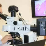 Biopsia cutanată: când este necesară și ce rol are în diagnosticul cancerului de piele