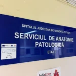 SJU Pitești: 20 de echipamente noi pentru diagnosticul oncologic